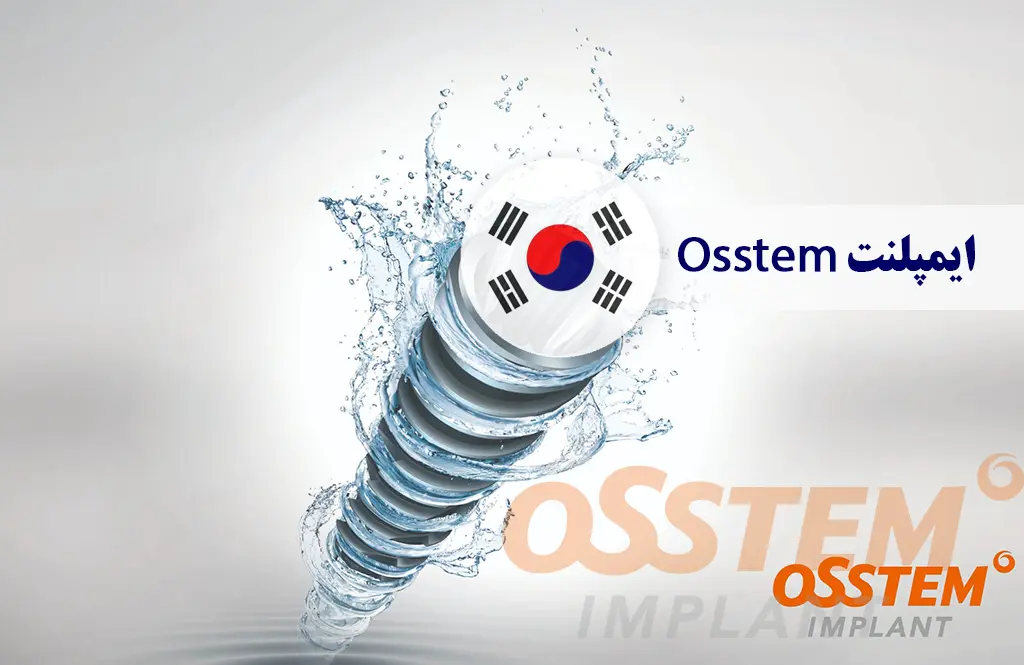 ایمپلنت اوستم (Osstem)