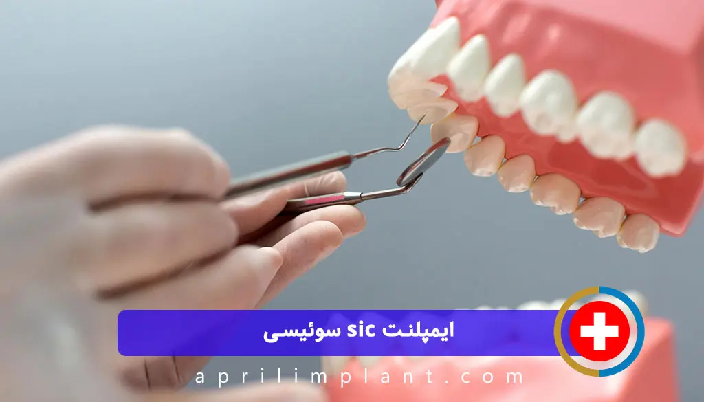 ایمپلنت sic
