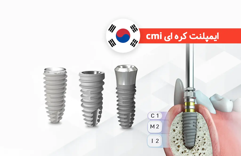 ایمپلنت سی ام آی