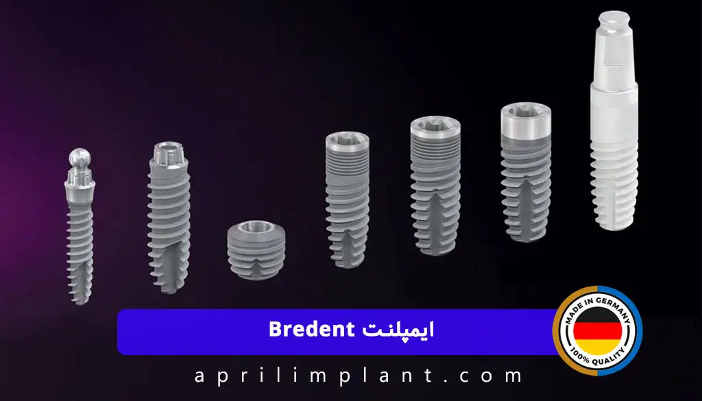 ایمپلنت بردنت