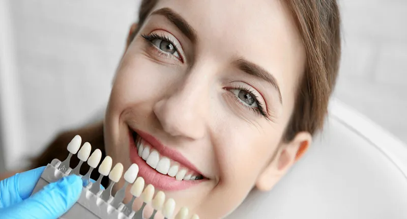 لمینت برای چه کسانی مناسب است؟