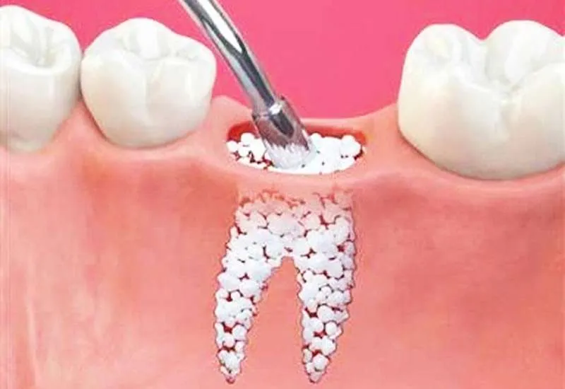 در این 3 حالت بعد از جراحی به پزشک مراجعه کنید!!
