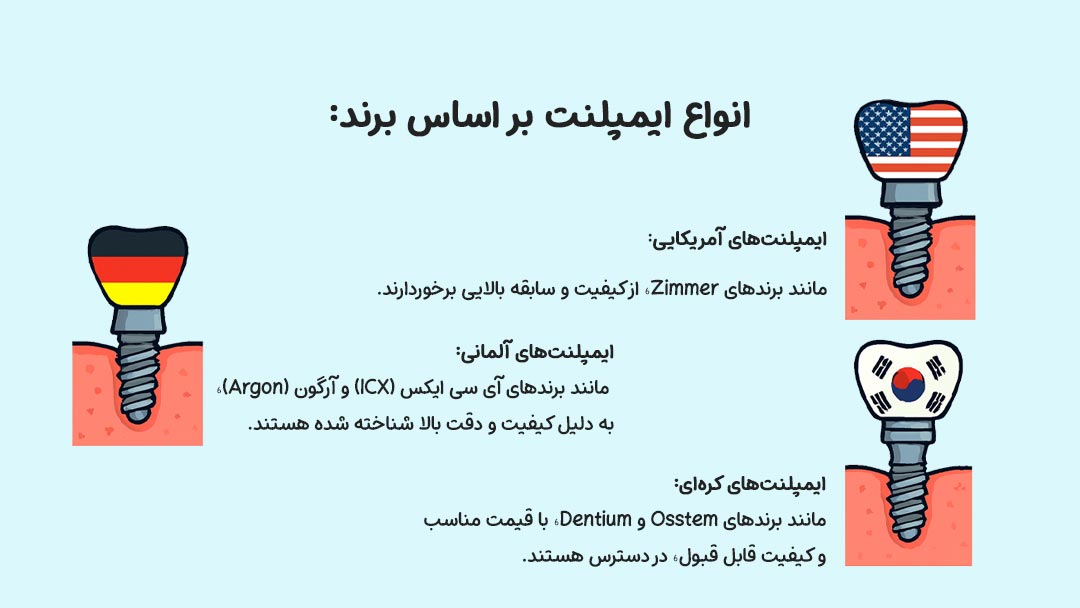 انواع ایمپلنت بر اساس برند